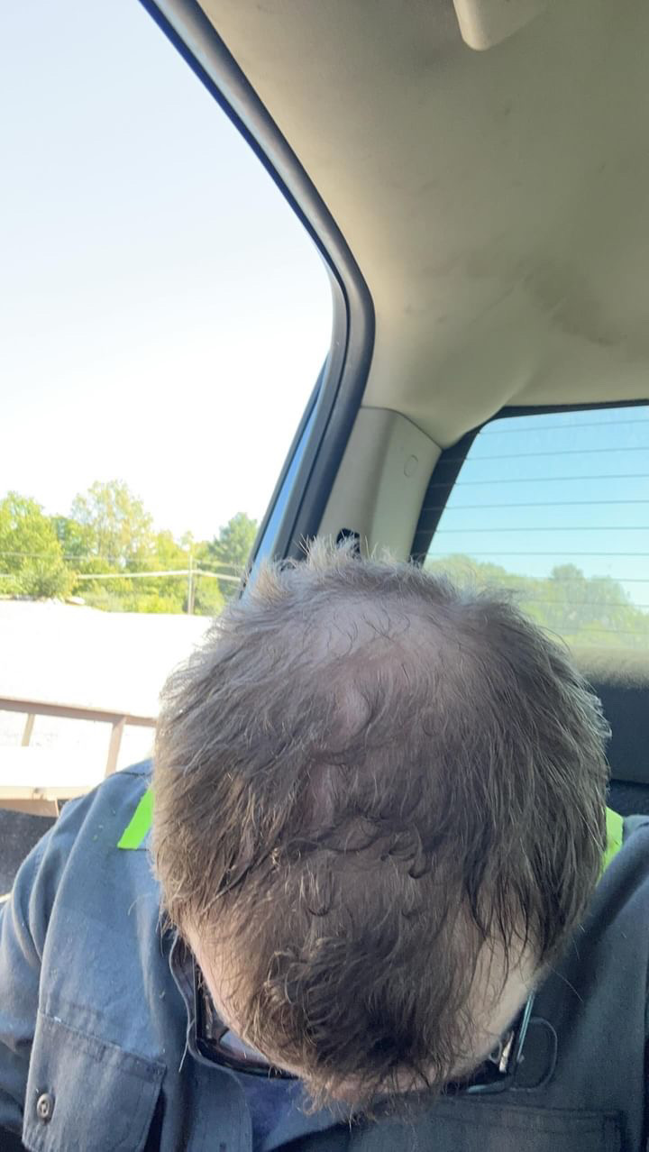 Hair Rescue reference comparison photograph