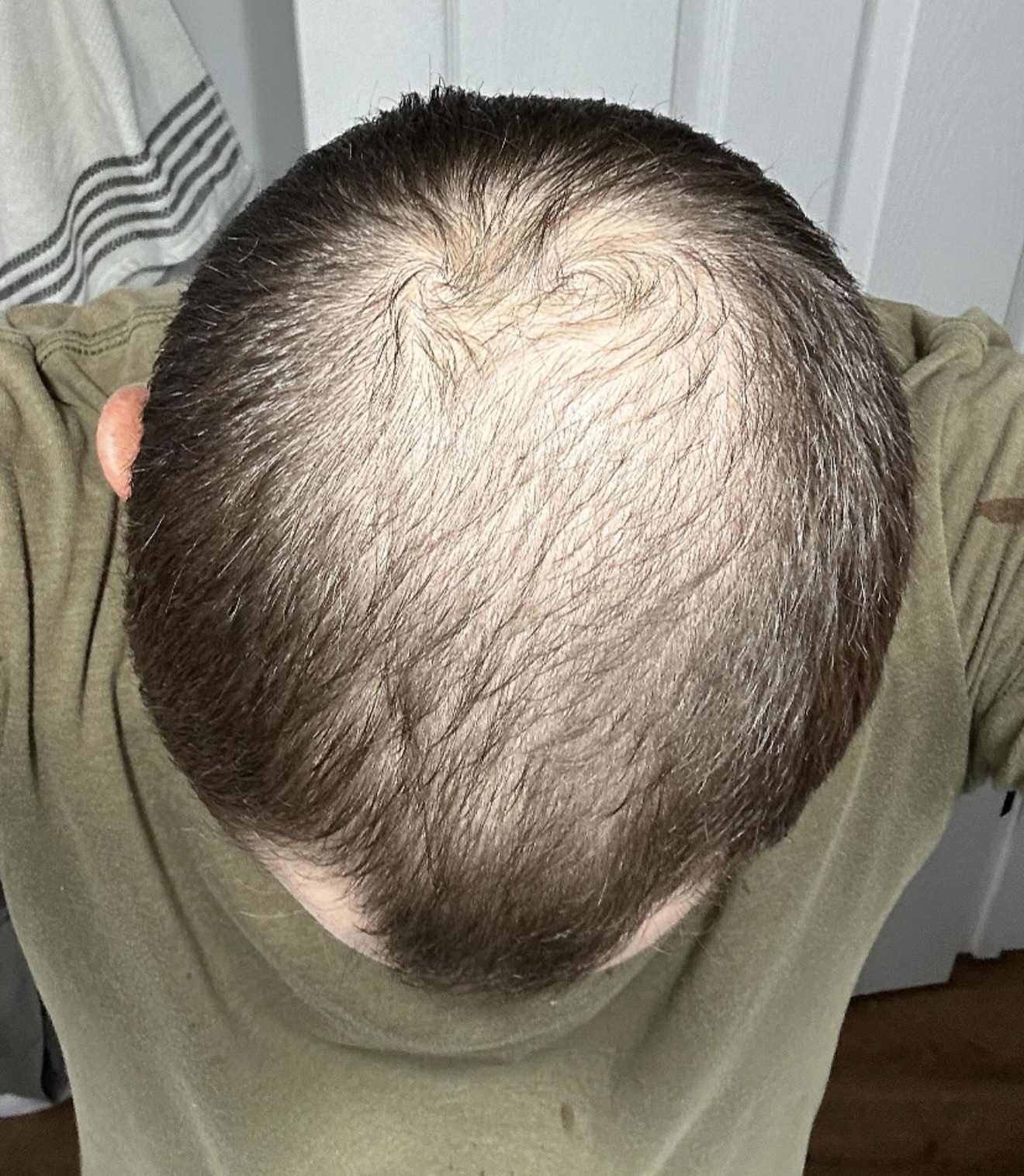 Hair Rescue reference comparison photograph