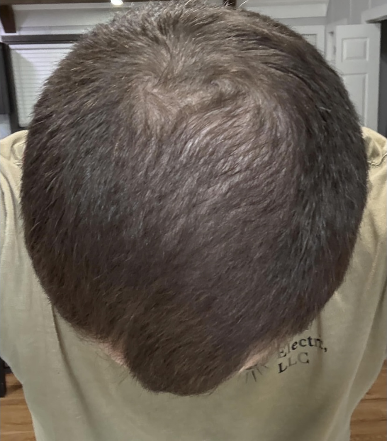 Hair Rescue reference comparison photograph