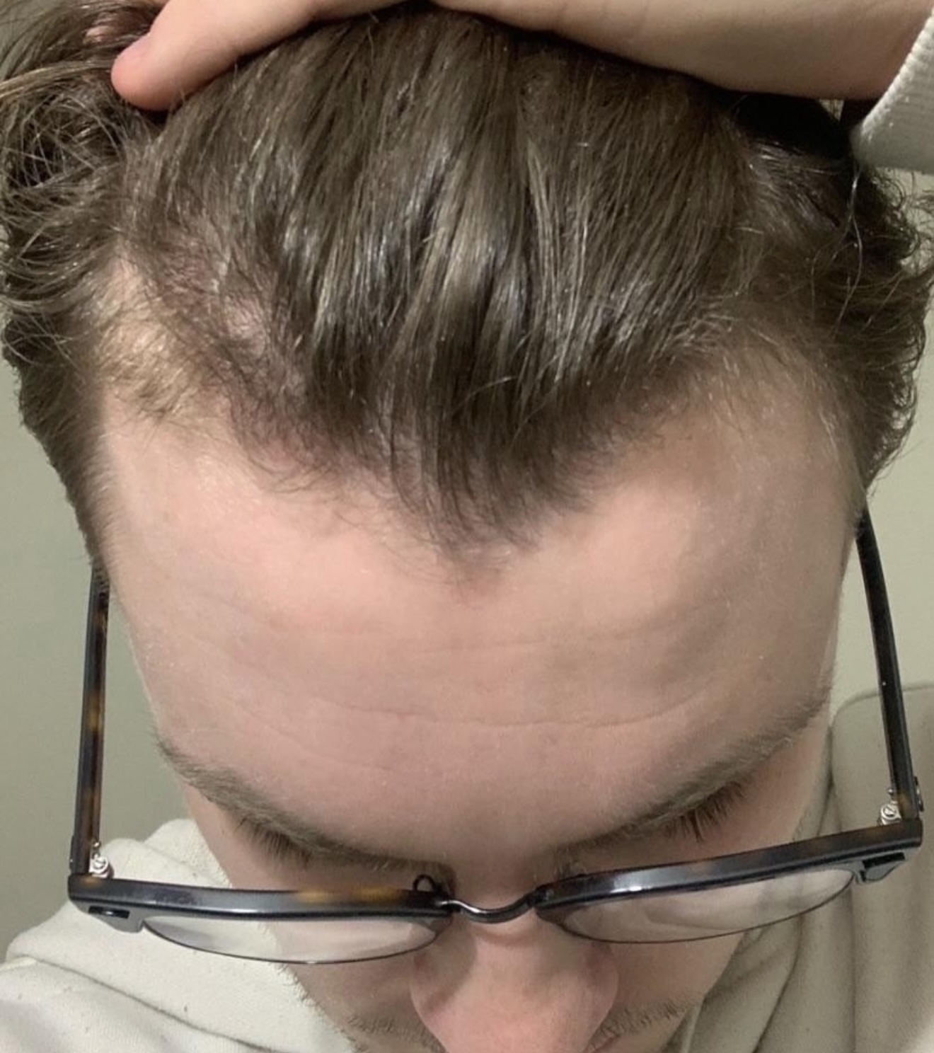 Hair Rescue reference comparison photograph