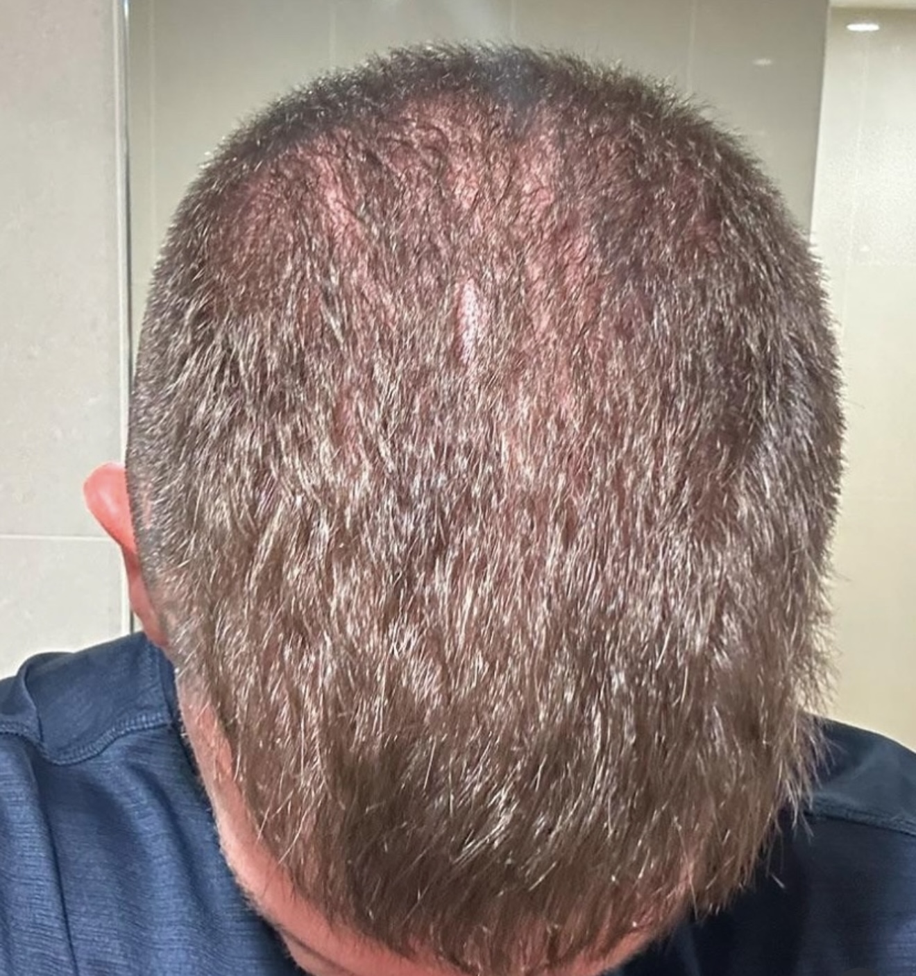 Hair Rescue reference comparison photograph