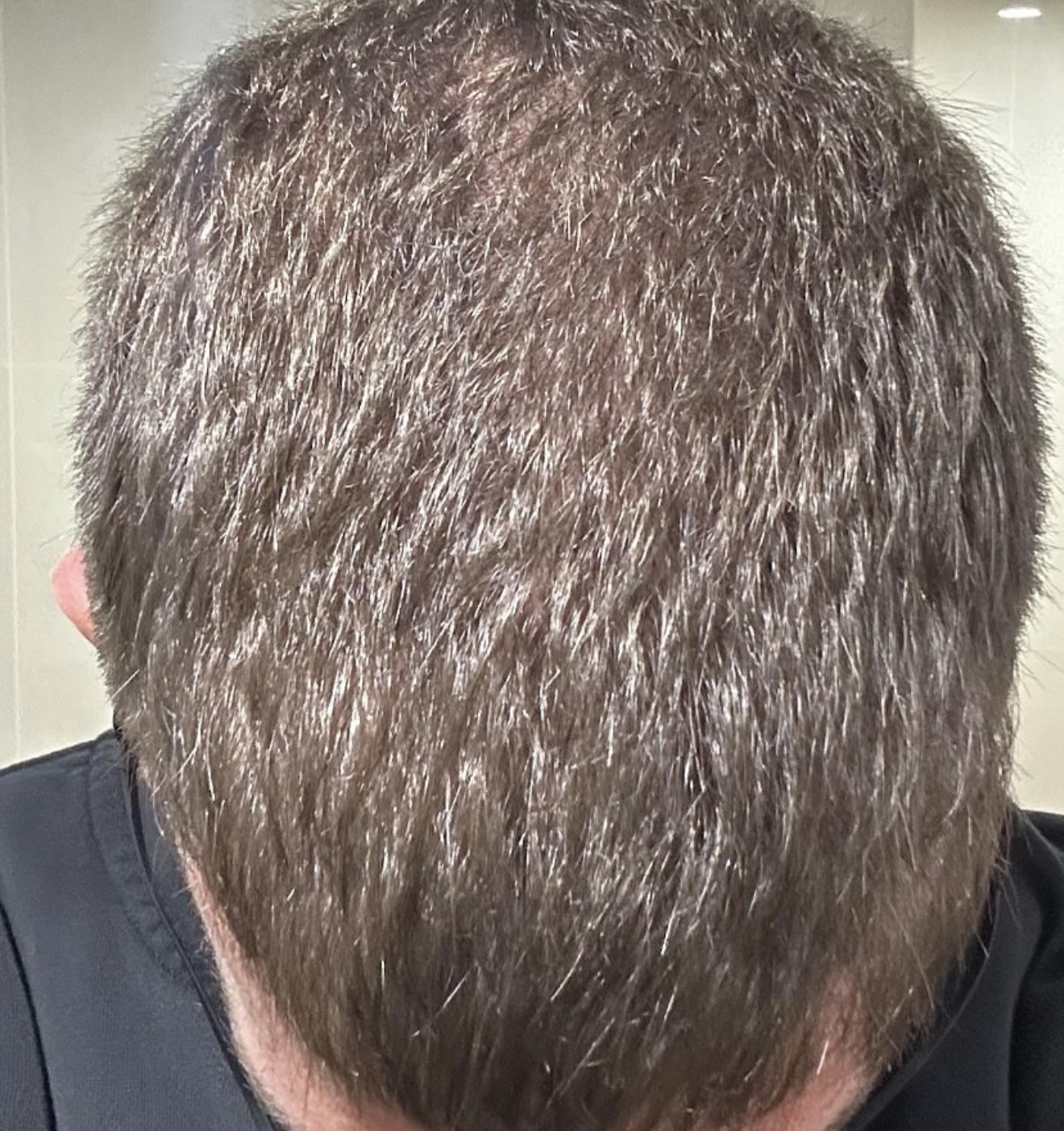 Hair Rescue reference comparison photograph