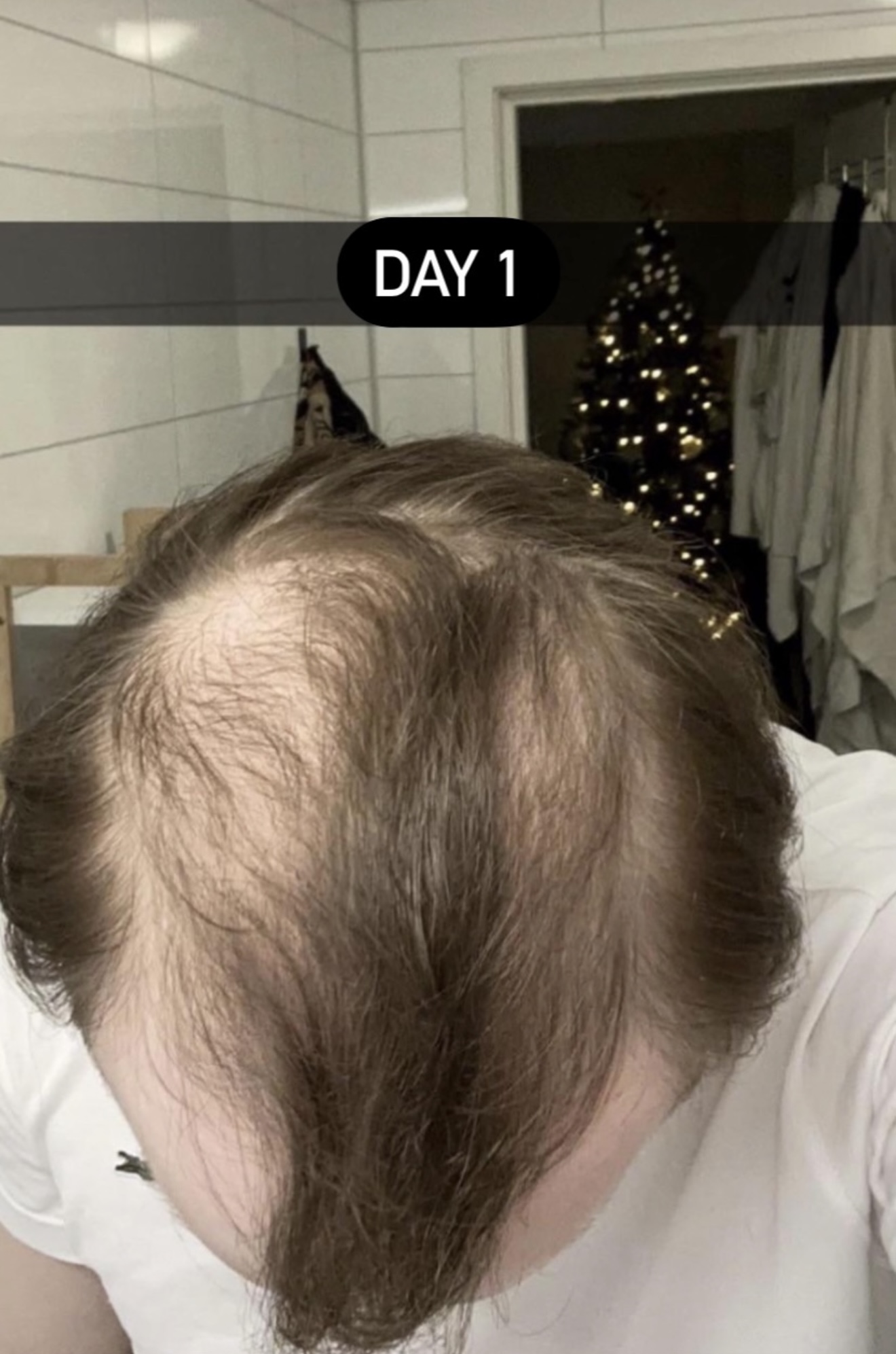 Hair Rescue reference — before photo