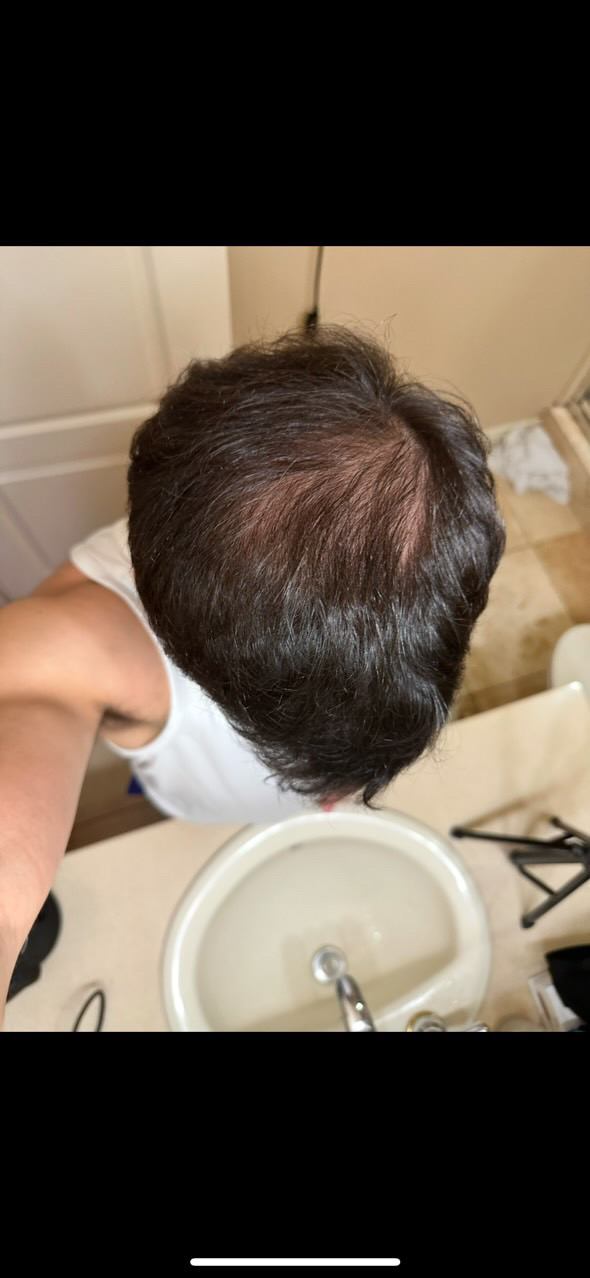 Hair Rescue reference comparison photograph