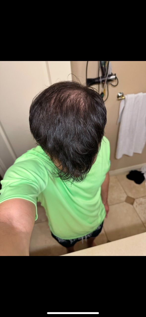 Hair Rescue reference comparison photograph