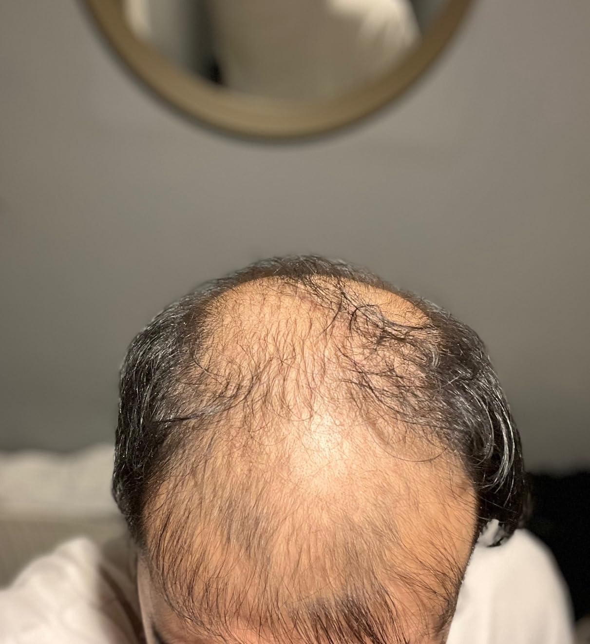 Hair Rescue reference comparison photograph