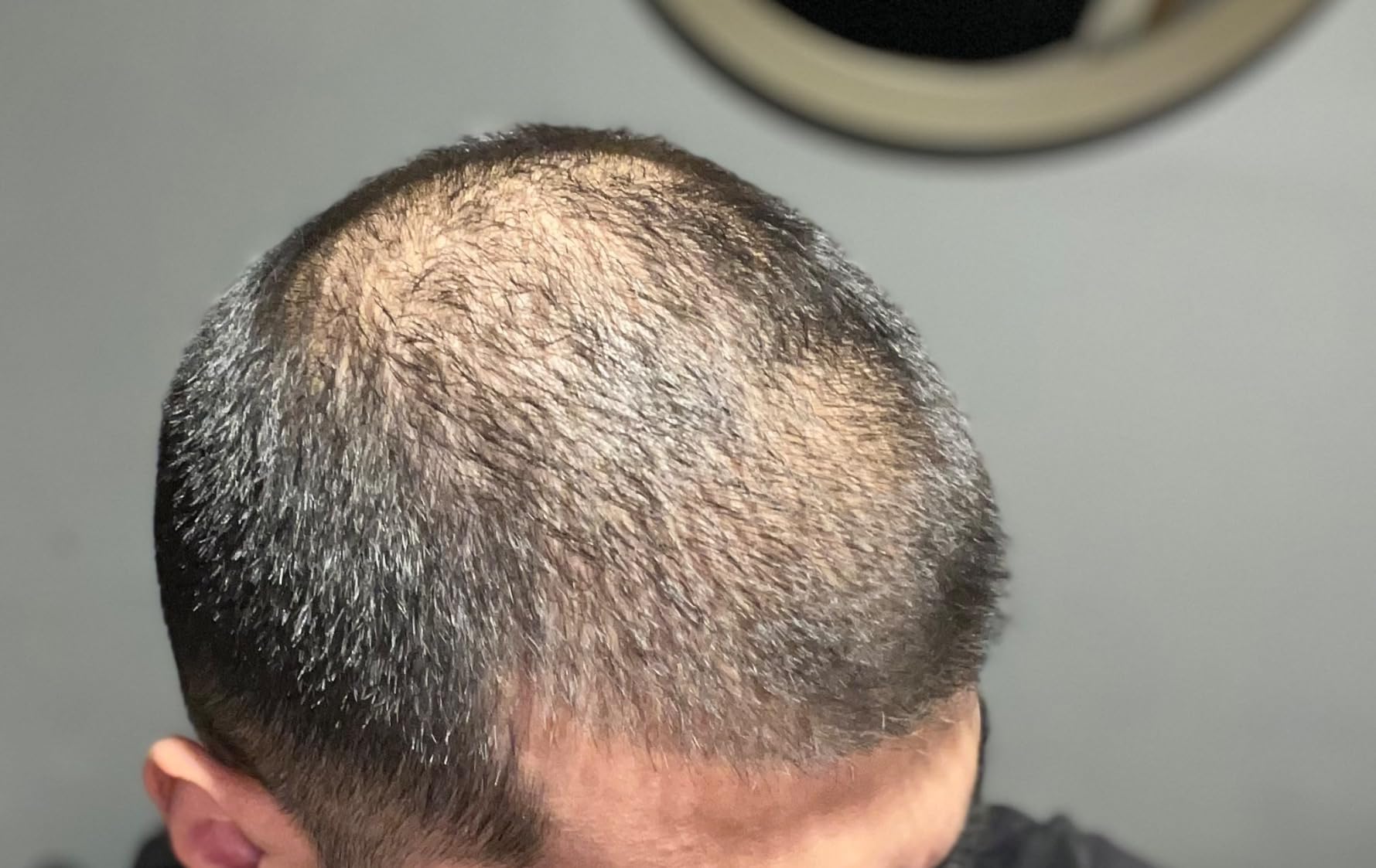 Hair Rescue reference comparison photograph