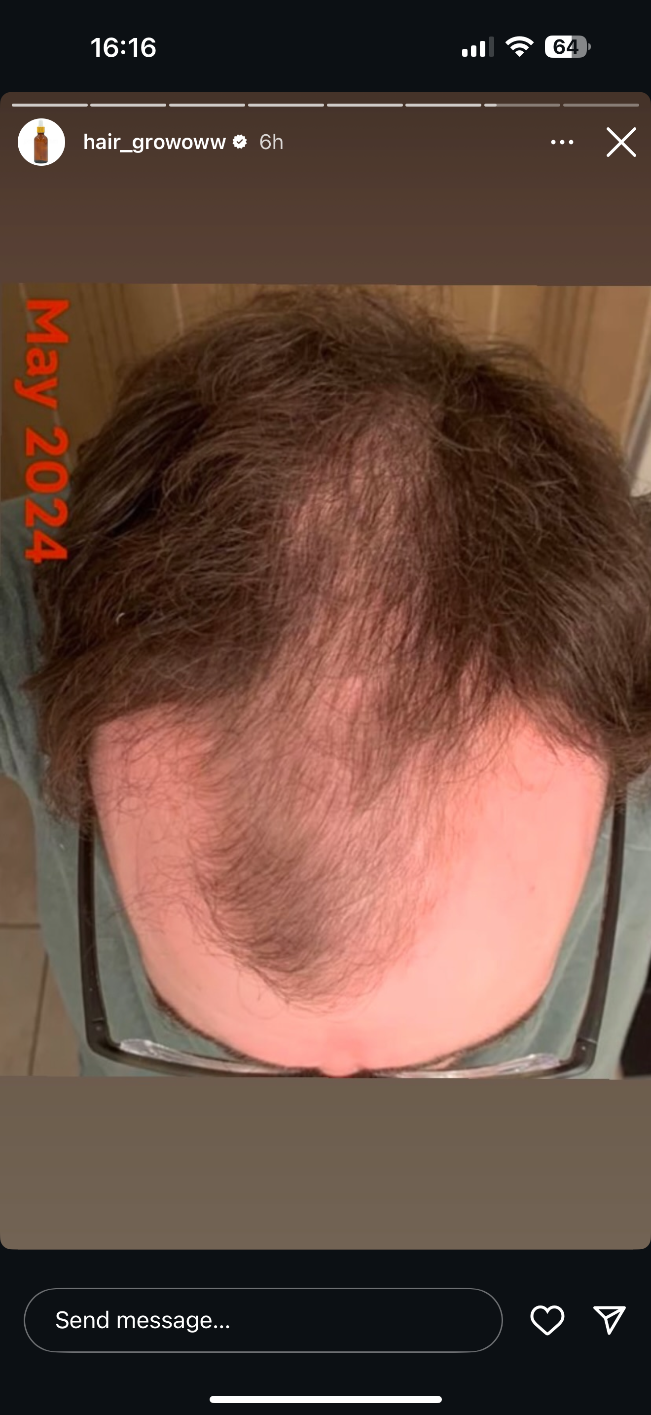 Hair Rescue reference comparison photograph