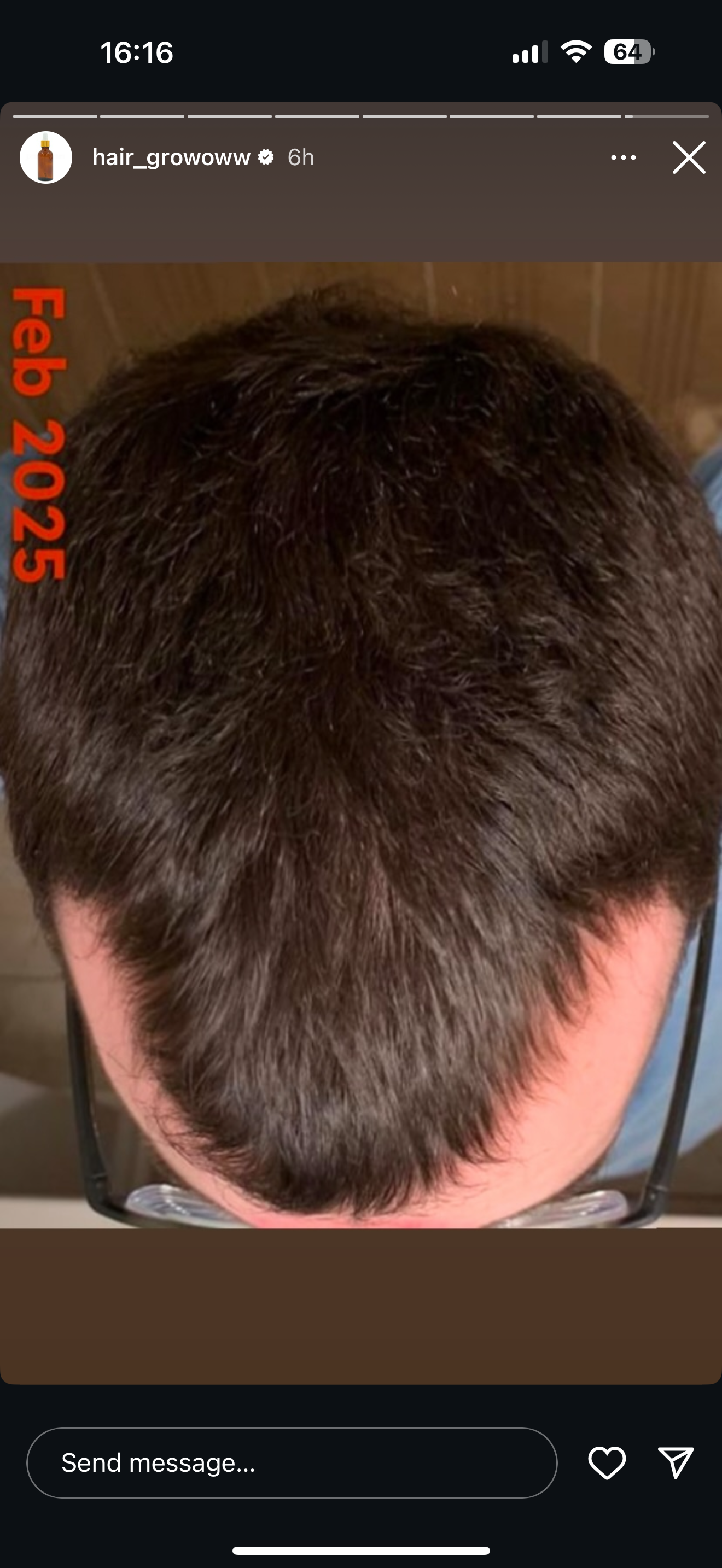 Hair Rescue reference comparison photograph