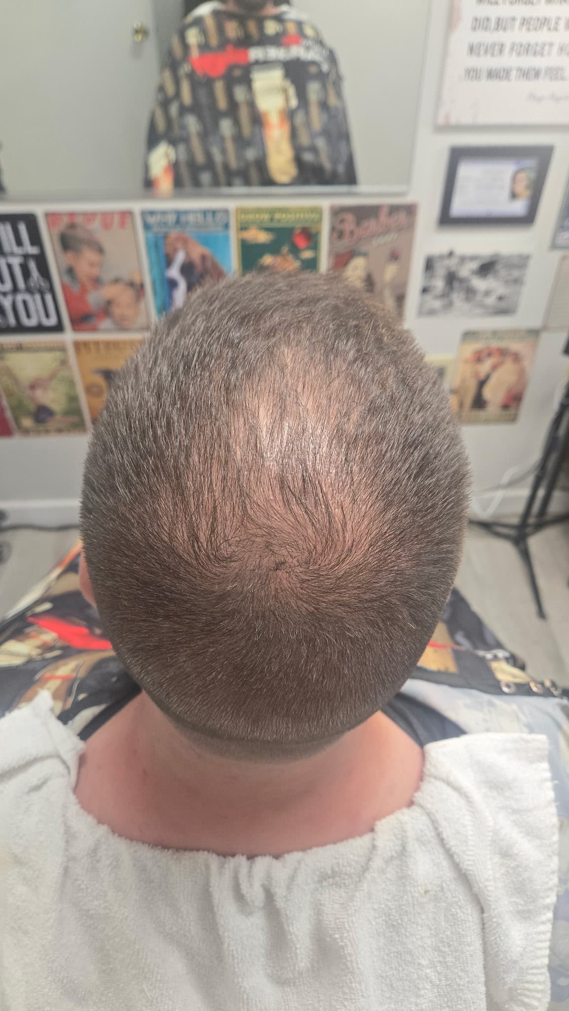After treatment