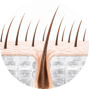 Hair follicle at 3-6 months