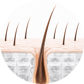 Hair follicle at 2-3 months