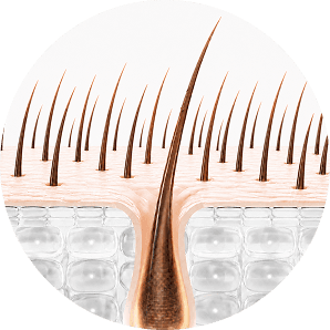 Hair follicle at 6-12 months