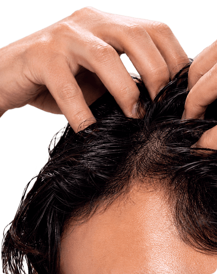 Massaging RU58841 Solution into the scalp