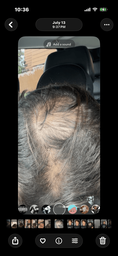 Before treatment