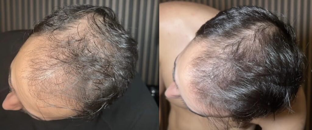 Hair Rescue reference comparison photograph