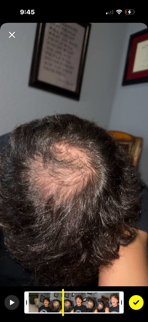 Hair Rescue reference comparison photograph