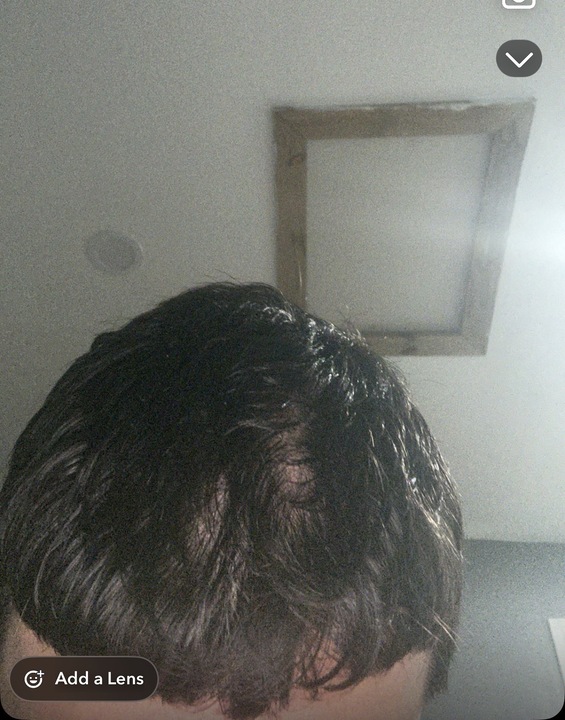 Hair Rescue reference comparison photograph
