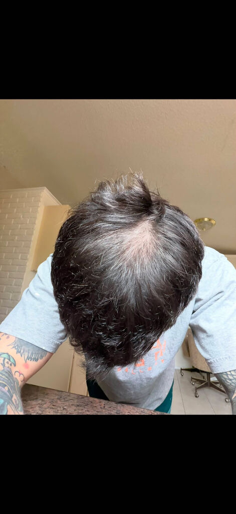 Hair Rescue reference comparison photograph