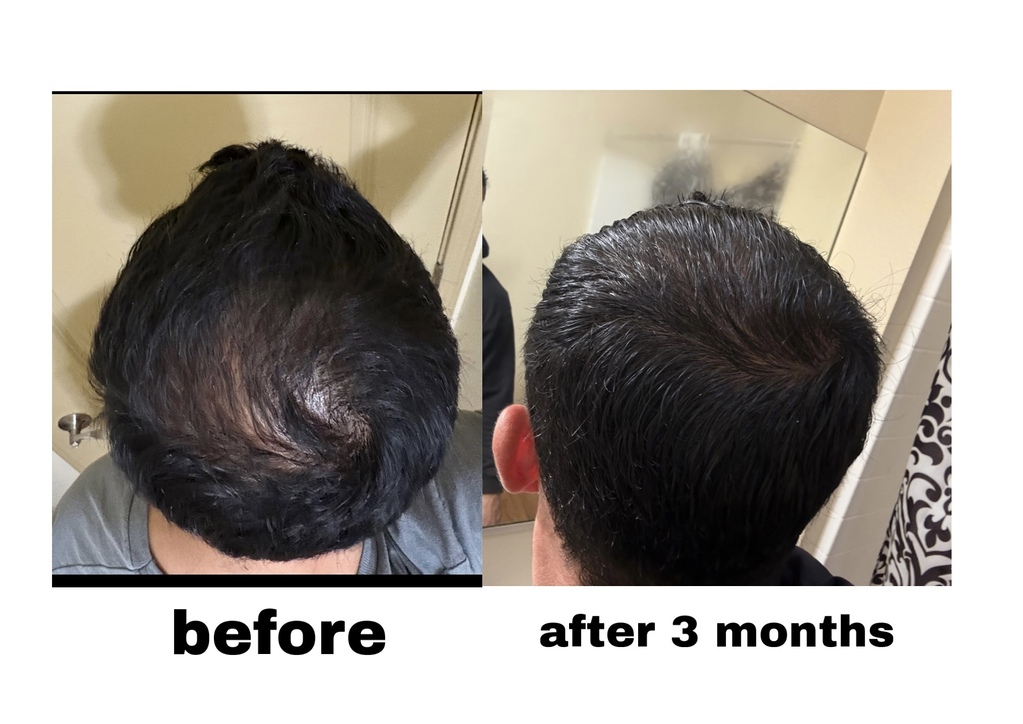 Hair Rescue reference comparison photograph